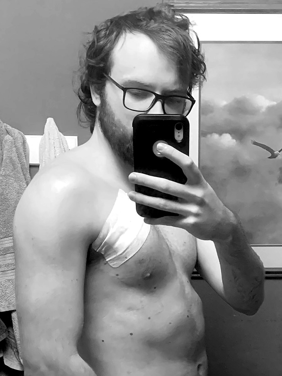 Miller with a surgical dressing on his chest and a hospital band on his wrist